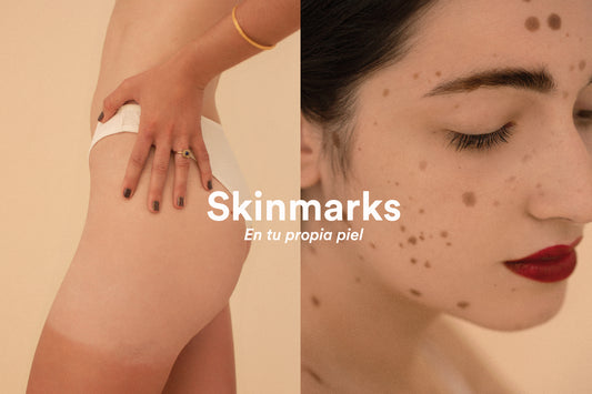 Skinmarks: En tu propia piel